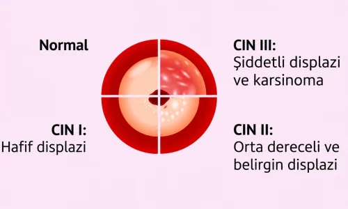 CİN1, CİN2, CİN3 nedir_