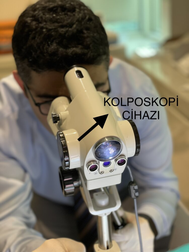 KOLPOSKOP LEM LE RAH M A ZI KANSER R SK N BEL RLEMEK M MK N KOLPOSKOP LEM LE RAH M A ZI KANSER R SK N BEL RLEMEK M MK N