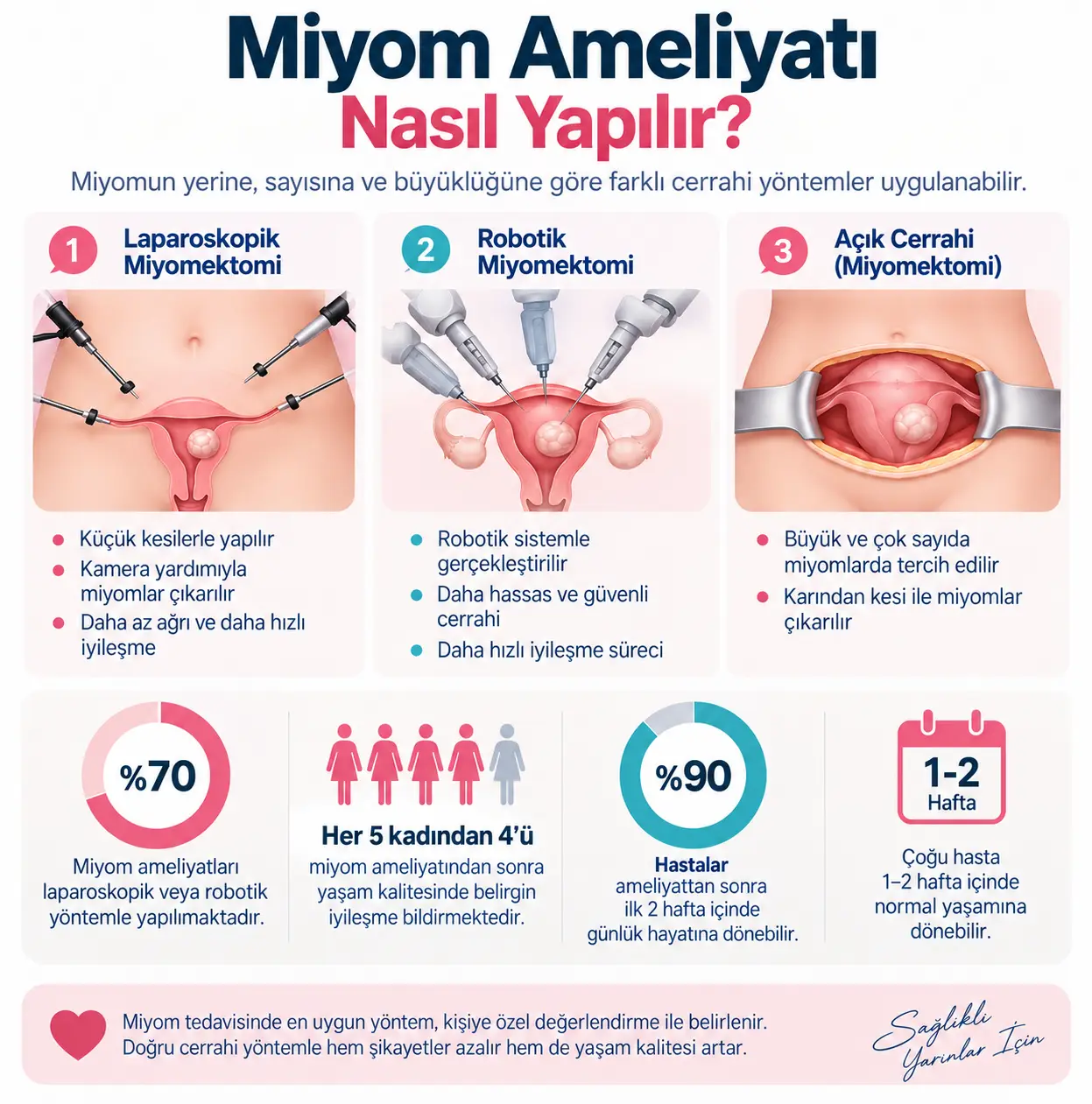 miyom ameliyatı nasıl yapılır